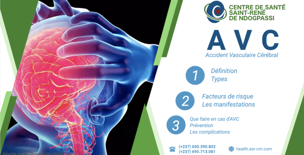 AVC (Accident Vasculaire Cérébral)